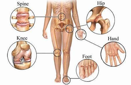 artroza bolii articulare a degetelor